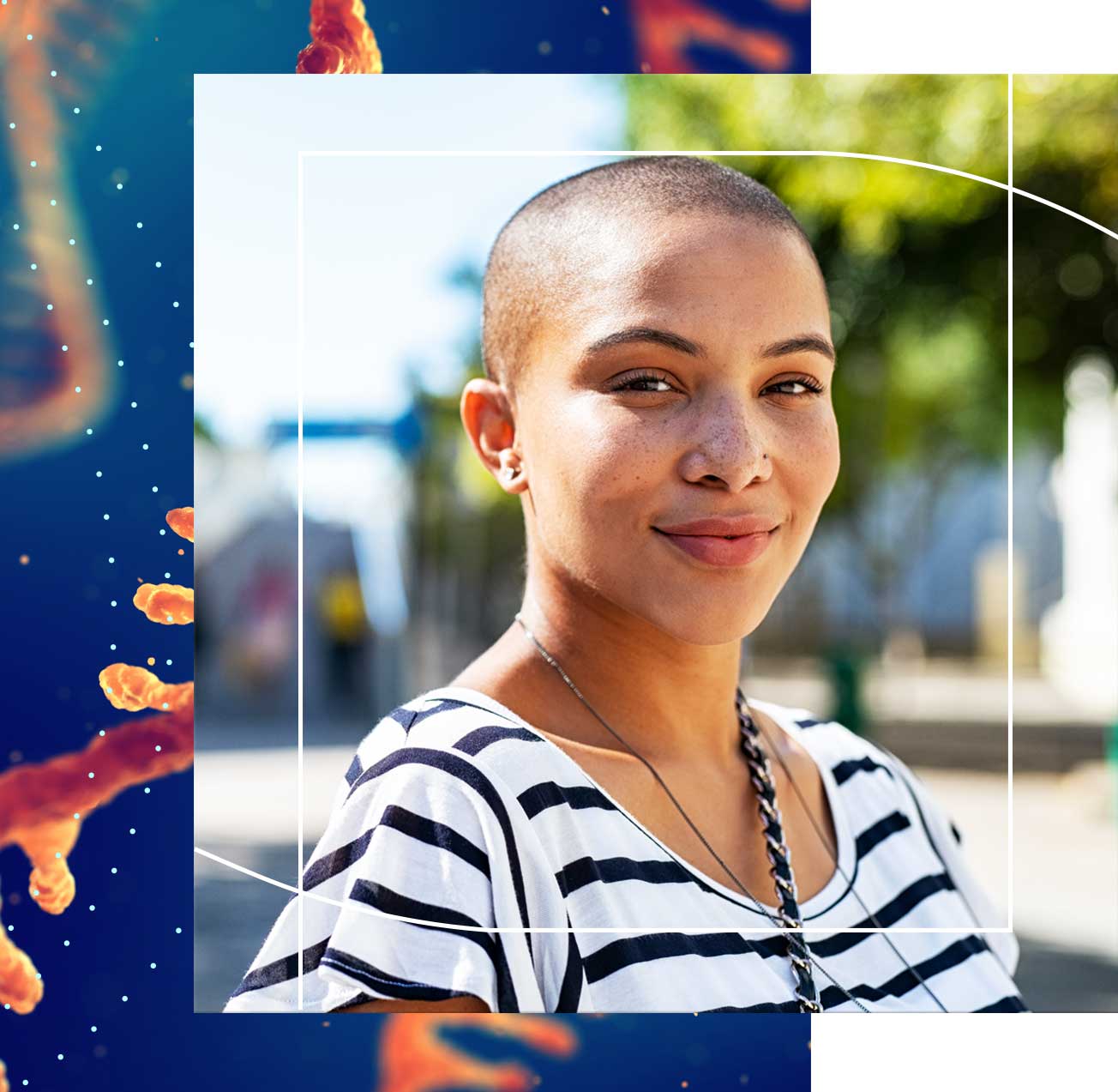 Polycystic Ovary Syndrome